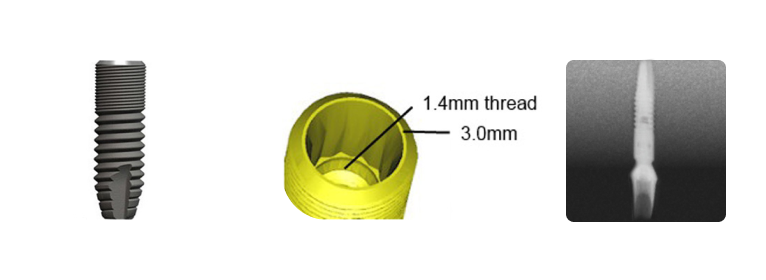Astra® 3.0s_0.png
